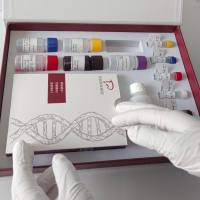 人尿肌酐ELISA检测试剂盒说明书