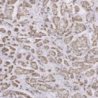 鼠抗人GATA3单克隆抗体  TDCGM-0130