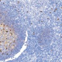 鼠抗人免疫球蛋白M单克隆抗体 TDCIM-0140