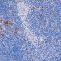 兔抗人粒酶B单克隆抗体 TDCGR-0211