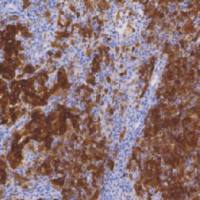 鼠抗人黑色素A单克隆抗体  TDCMM-0130