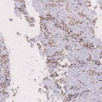 鼠抗人INI-1单克隆抗体 TDCIM-0160