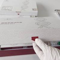 人血小板生长因子(PGF)ELISA试剂盒价格