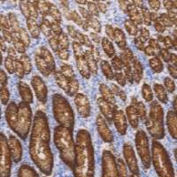 鼠抗人Claudin 18.2单克隆抗体  TDCCM-1270