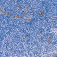 鼠抗人第八因子相关抗原单克隆抗体  TDCFM-0020