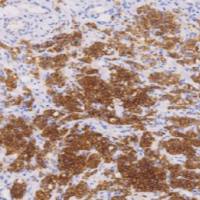 兔抗人IMP3单克隆抗体 TDCIR-0180