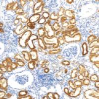 鼠抗人Napsin A单克隆抗体 TDCNM-0012