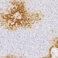 鼠抗人谷氨酰氨合成酶单克隆抗体  TDCGM-0190