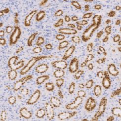 兔抗人Pax-2单克隆抗体  TDCPR-0232