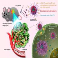 整合素靶向肽修饰脂质体纳米颗粒 RGD