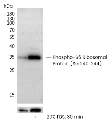 体型控制器：S6K1