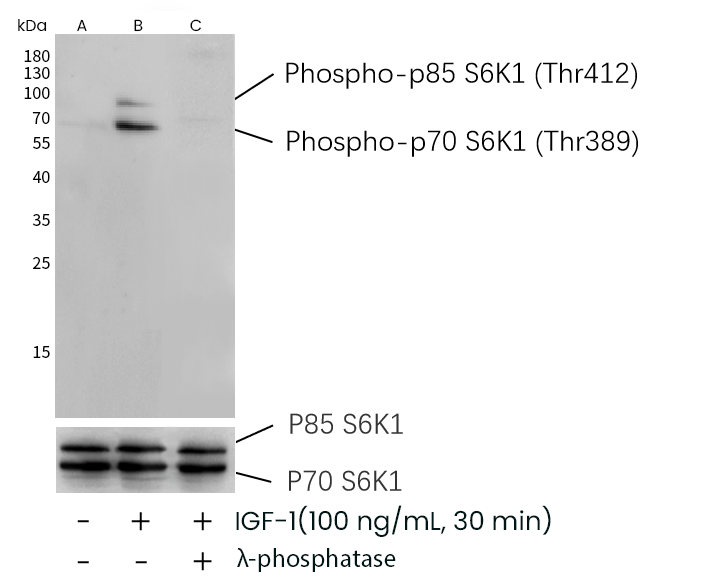 体型控制器：S6K1