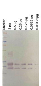 PtX™ Rabbit Anti-IFN-γ