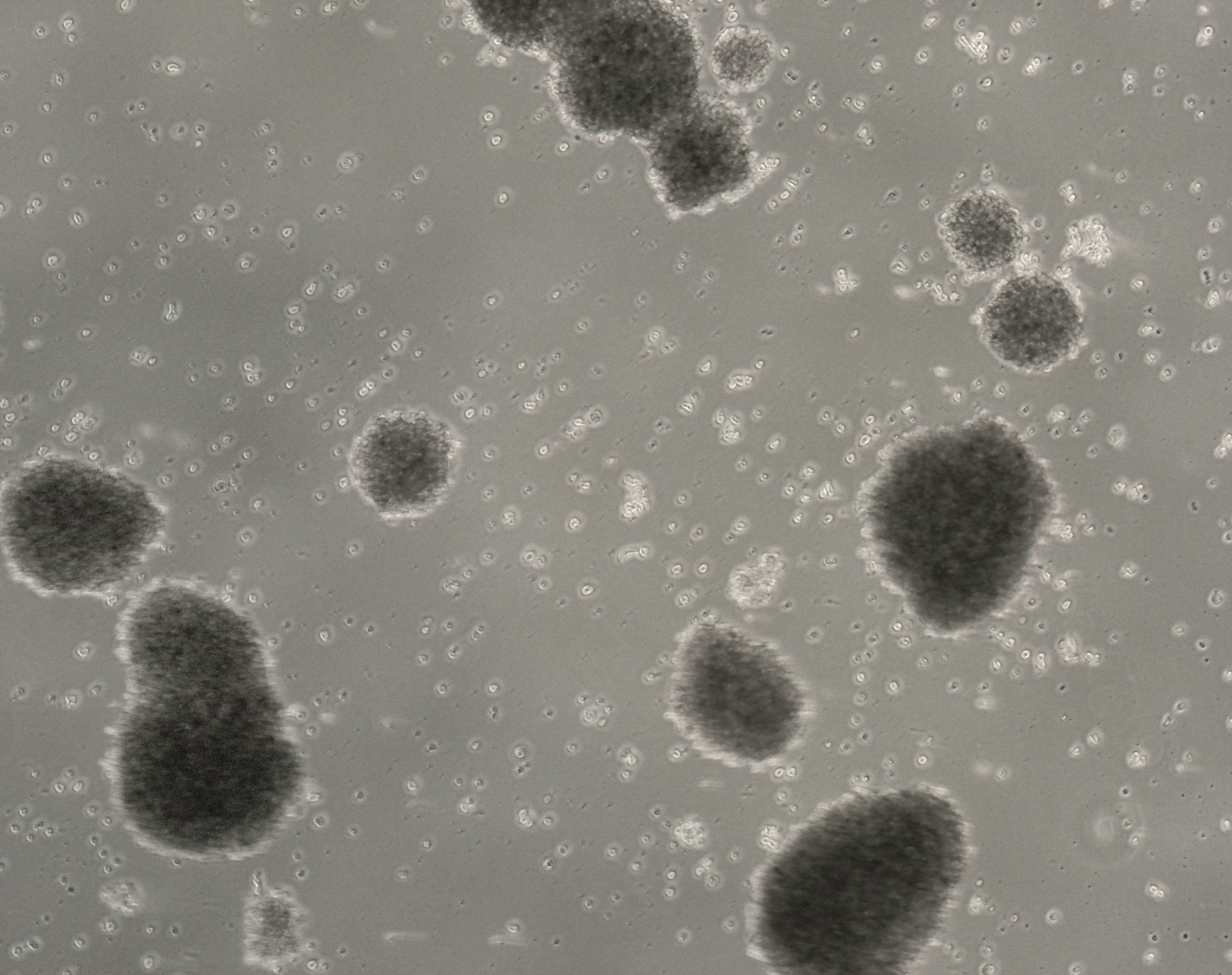 细胞攻略 | NK-92(人恶性非霍奇金淋巴瘤患者的自然杀伤细胞)培养教程