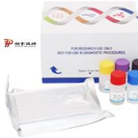 猪血小板衍生生长因子(PDGF)酶联免疫试剂盒