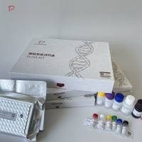 人纤溶酶原激活物抑制因子1(PAI-1)ELISA试剂盒价格