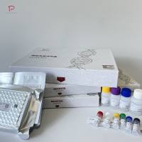 人可溶性P选择素(sP-selectin)ELISA试剂盒，免费代测