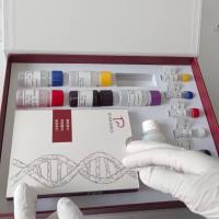 人内皮抑素(ES)ELISA试剂盒操作原理