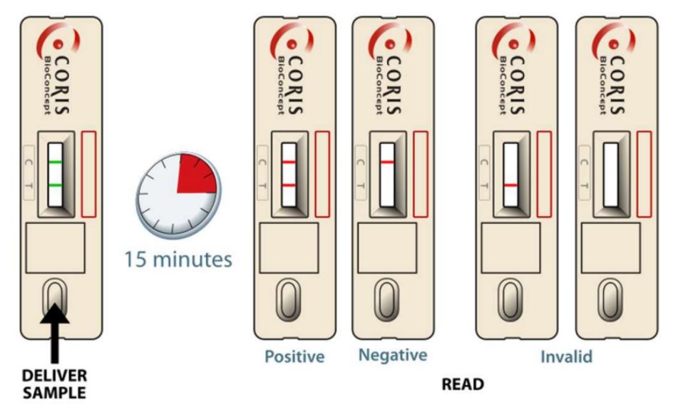 细菌培养物中OXA-48碳青霉烯酶检测试剂盒