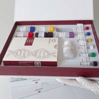 人肿瘤坏死因子β(TNF-β)ELISA试剂盒灵敏高 重复性好