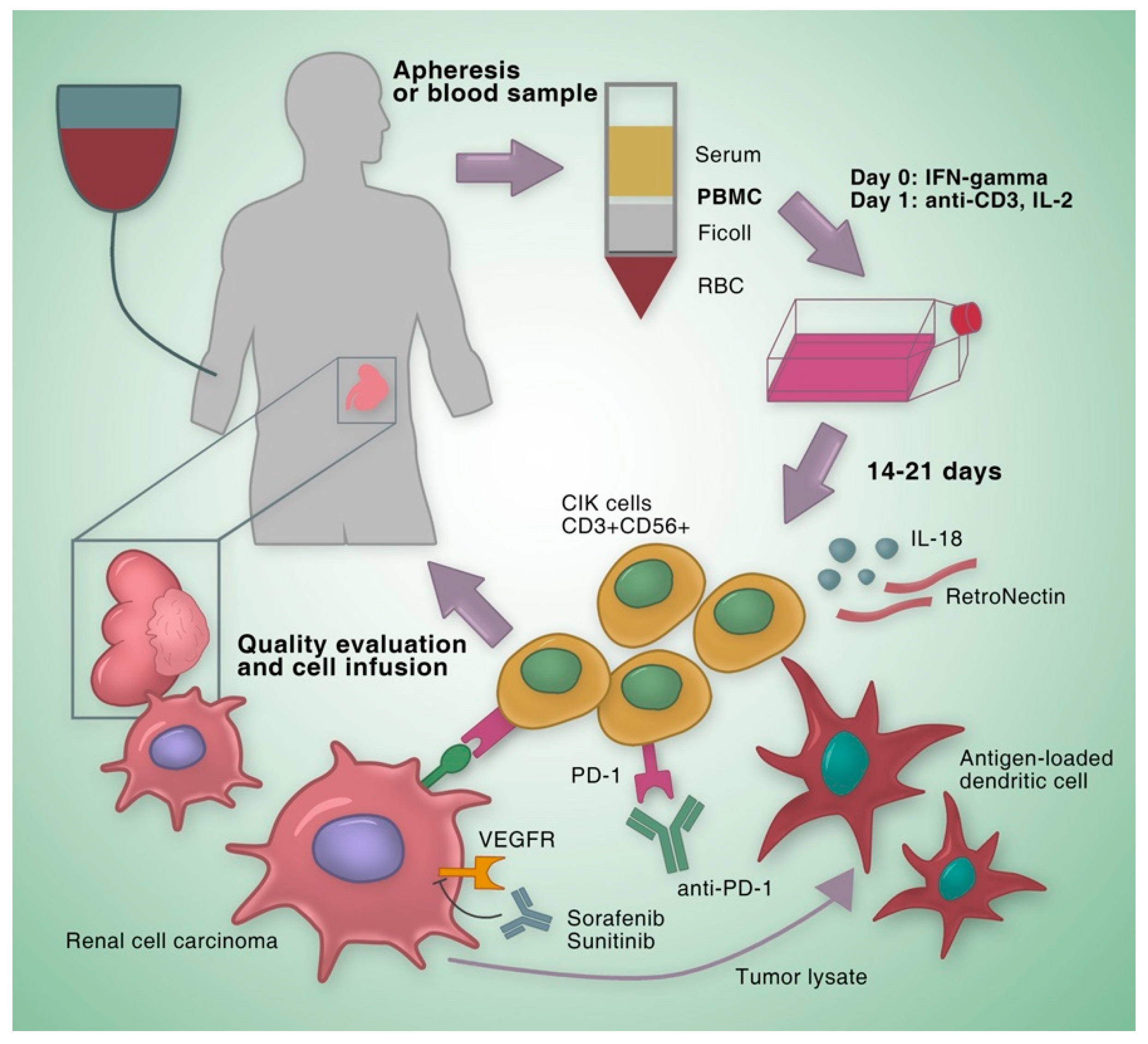 人CIK细胞培养方案