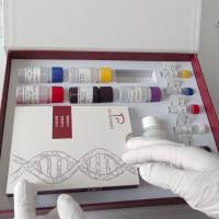 人基质金属蛋白酶抑制因子2(TIMP-2)ELISA试剂盒