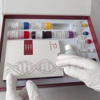 人血管内皮细胞生长因子受体2(VEGFR-2)ELISA试剂盒