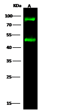 钙粘蛋白CDH：肿瘤靶点研究新秀