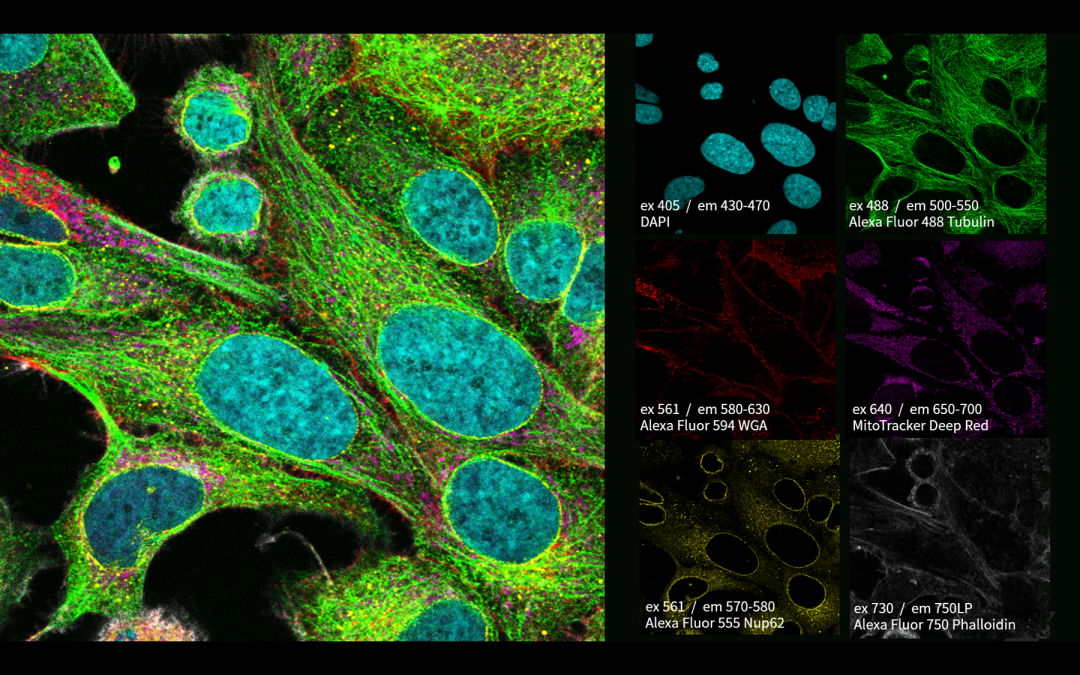 新品上市丨EVIDENT全新激光扫描共聚焦系统FV4000重磅发布