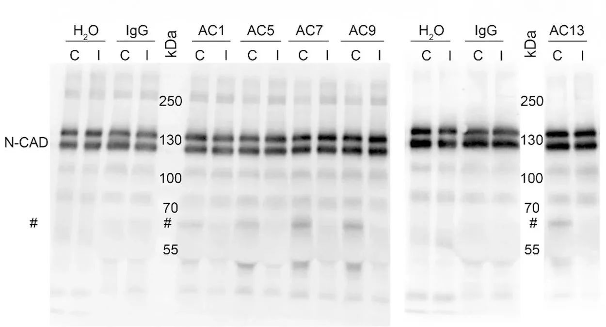 钙粘蛋白CDH：肿瘤靶点研究新秀