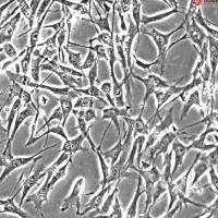 人骨骼肌卫星细胞 (Sciencell进口)