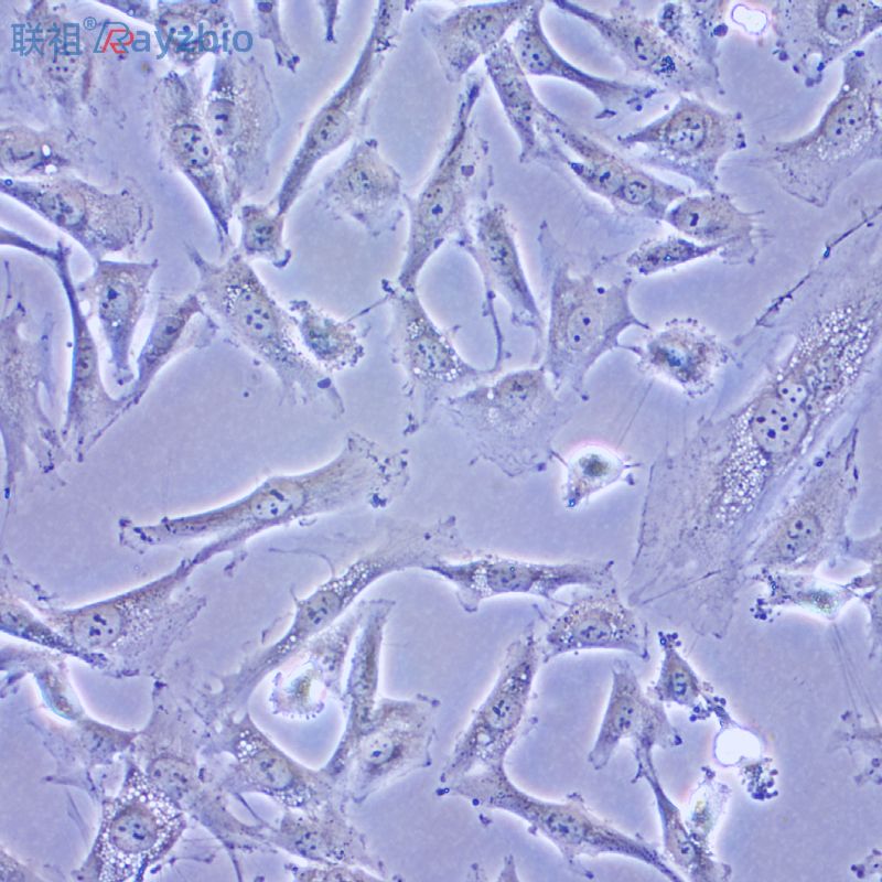 人II型肺泡上皮细胞
