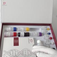 人白介素10(IL-10)ELISA试剂盒特异性强，准确度高