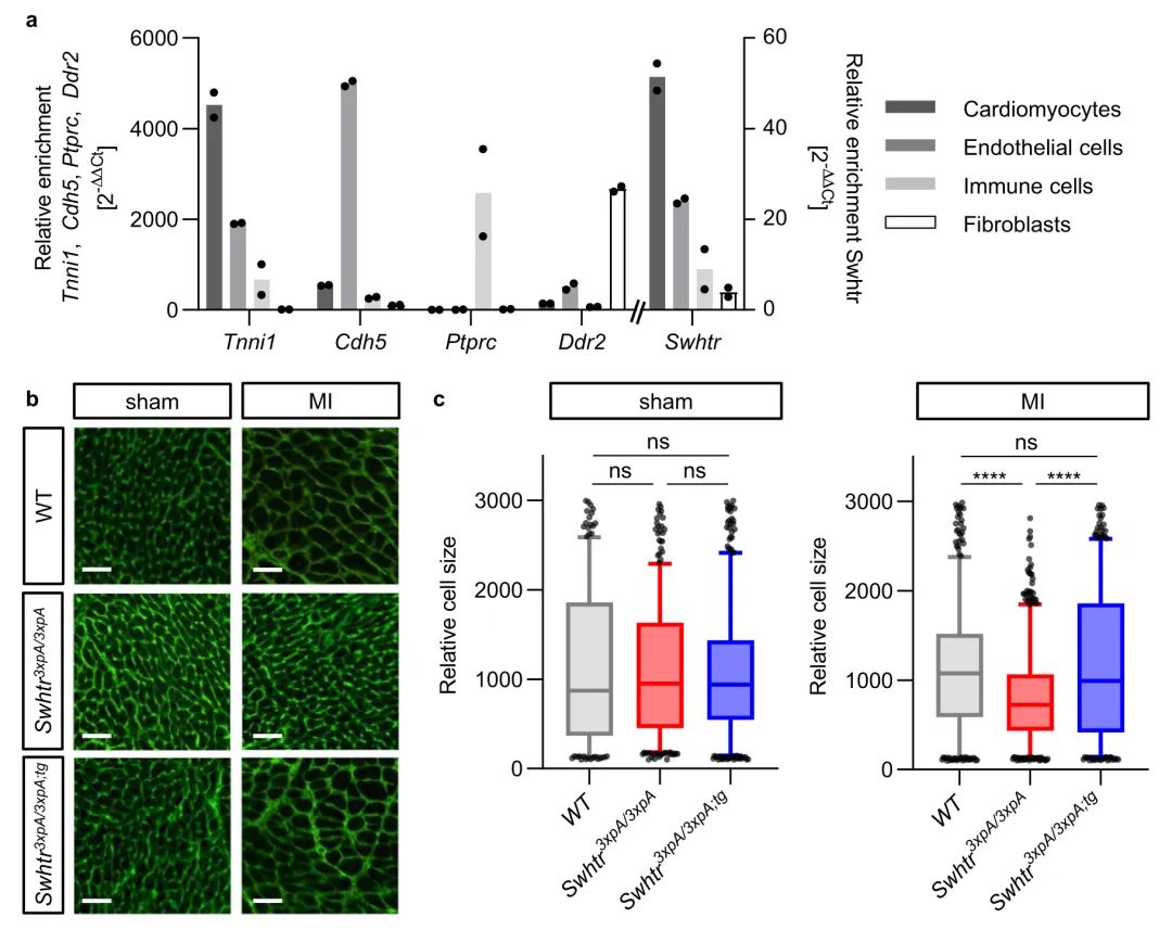lncRNA研究进展盘点丨20231107期