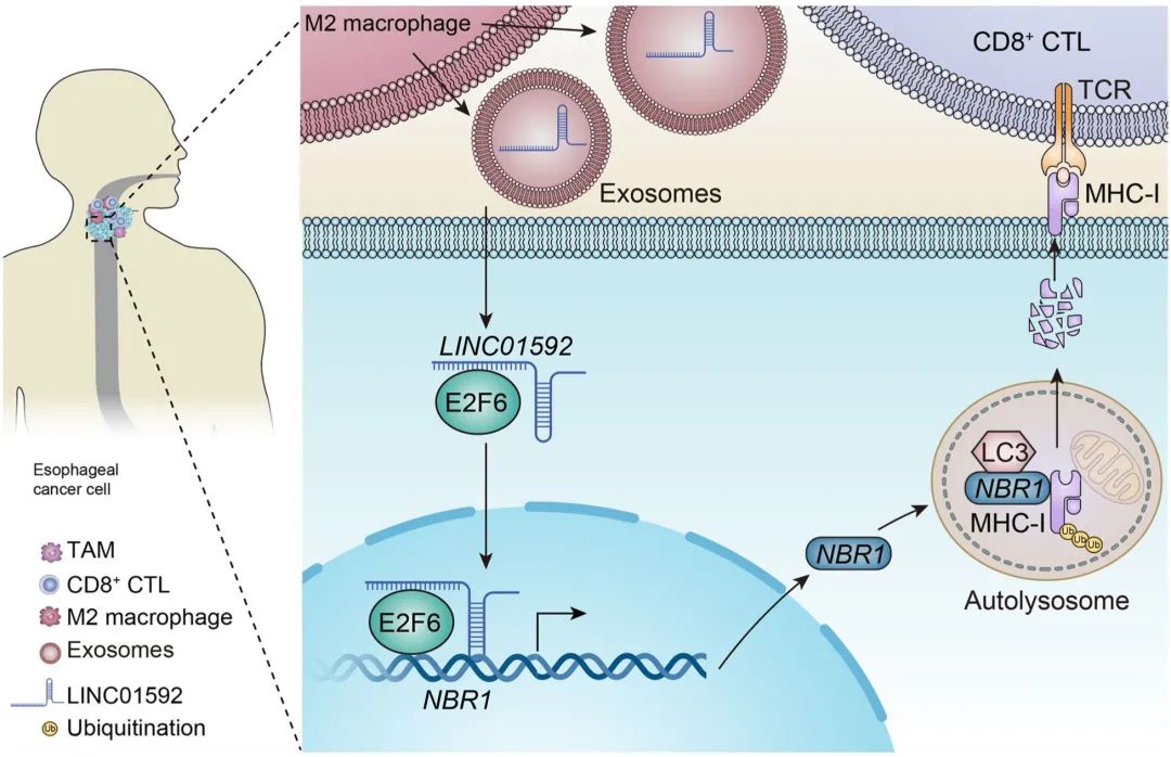 jeccrif11丨tams源性外泌體linc01592誘導食管癌免疫逃逸