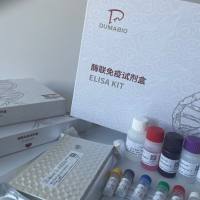 人二级淋巴组织趋化因子(SLC/CCL21)ELISA试剂盒