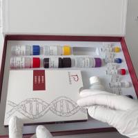 人XC趋化因子受体1(XCR1)ELISA试剂盒操作步骤