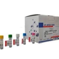 人类嗜T淋巴细胞病毒2型RT-PCR