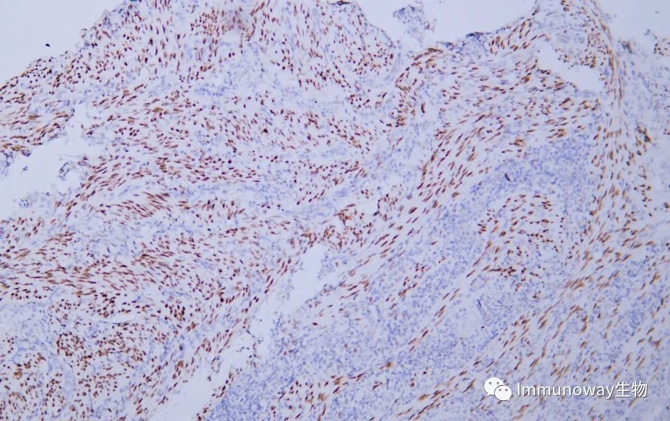 病理级 Polymer 酶标二抗│让 IHC 染色结果更精准、明亮和清晰
