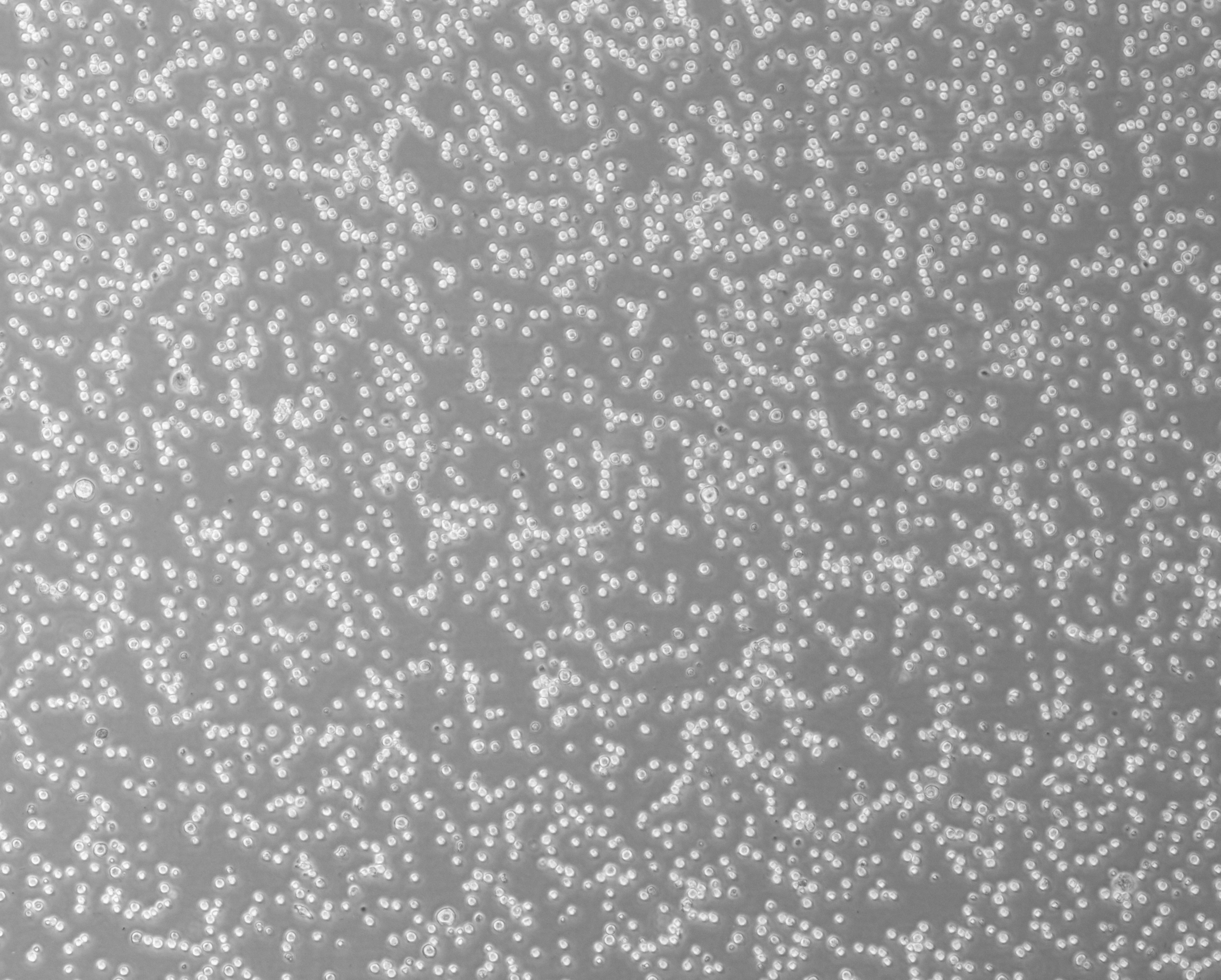 细胞攻略 | RPMI 8226(人多发性骨髓瘤细胞)培养教程