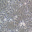 HCMEC/D3人脑微血管内皮细胞（永生化）
