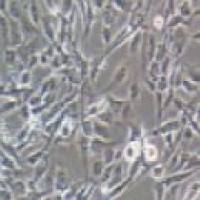 HCMEC/D3人脑微血管内皮细胞（永生化）