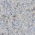 Sp2/0小鼠骨髓瘤细胞（种属鉴定）