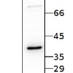 RBP40 | 38 kDa RNA-binding protein