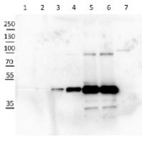 cFBPase | Cytosolic fructose-1,6-bisphosphatase (cytoplasm marker in photosynthetic tissues)