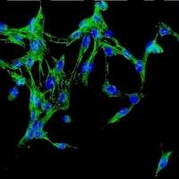 人肾上腺成纤维细胞