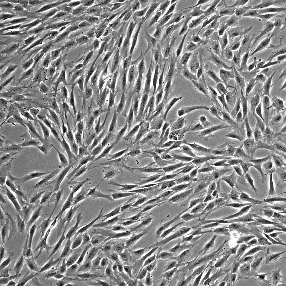 人间充质干细胞-骨髓