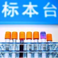 胆汁酸定量检测分析