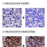 病理图像分析系统 AP-TIME 软件功能