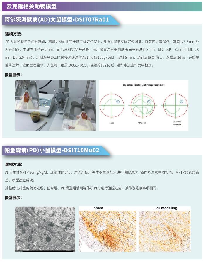 帕金森潜在治疗方法研究新发现
